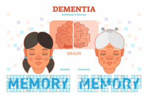 Alzheimer's